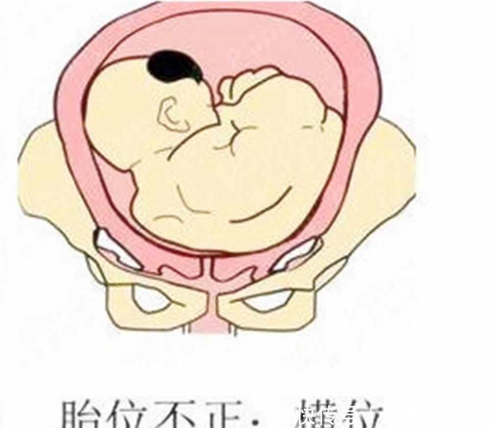宝宝|怀孕后多久,胎位就要固定了?这个孕周前,孕妈还能“调乾坤”