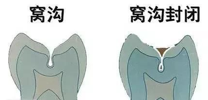 牙齿|该如何做才能保护好宝宝的牙齿