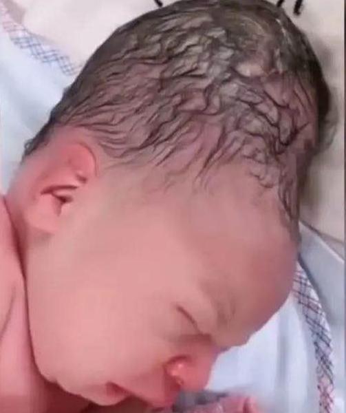 妈妈|“外星人宝宝”火了,刚出生丑哭宝妈,2个月后颜值成功逆袭