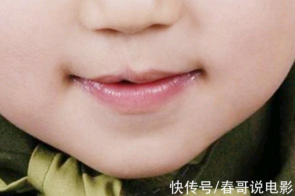 叶酸|为何在孕期正常吃叶酸,胎儿还会“唇腭裂”?孕妈别耍小聪明了