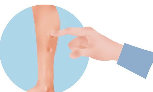 肺部问题,生活小细节你不容忽视,如果症状开始出现,得尽早就医