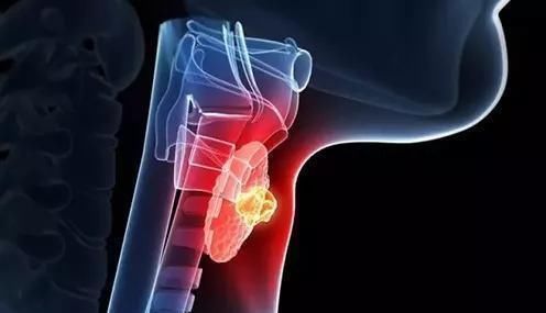 形态|钙化是癌变的信号和哪些癌症息息相关呢