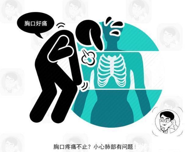 患者|肺癌除了胸痛外,若还有这4个表现,警惕癌症已到中晚期