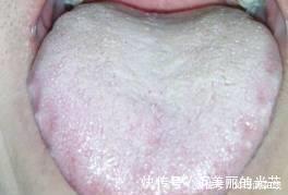 疾病|早晚吃一物,排出体内多年湿气,健康又漂亮,神奇!