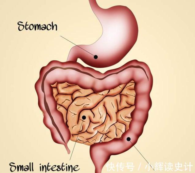 肠癌|95%的肠癌是息肉惹的祸!这样做轻松阻断它的癌变之路!