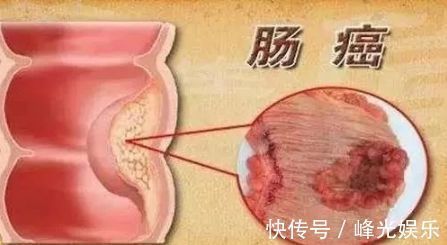 抗癌|8种癌都怕这种菜!但99%的人都吃错了,配上它,营养翻倍~