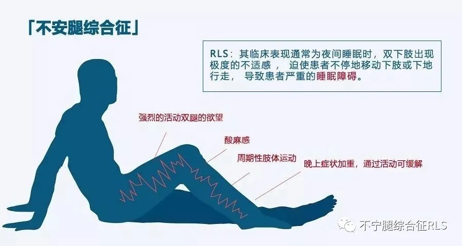 临床|不安腿的临床表现有哪些?