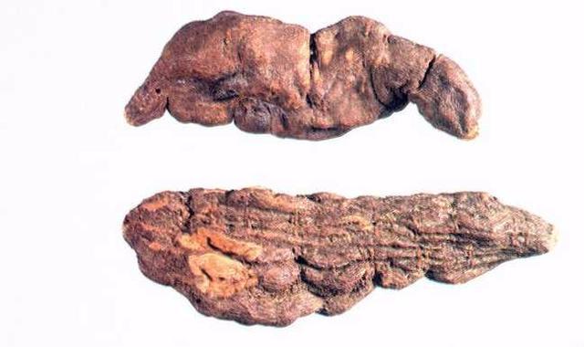 头发|6味中药泡水喝，补气血，白发没了，发量多了，显年轻