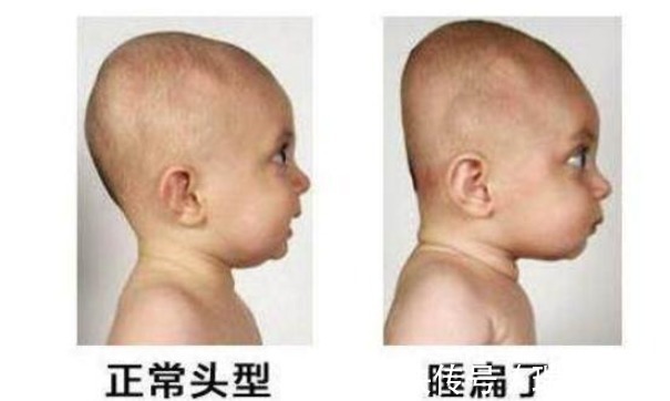 头部|宝宝睡觉时发生这3种“现象”,说明宝宝该枕枕头了,家长需留意