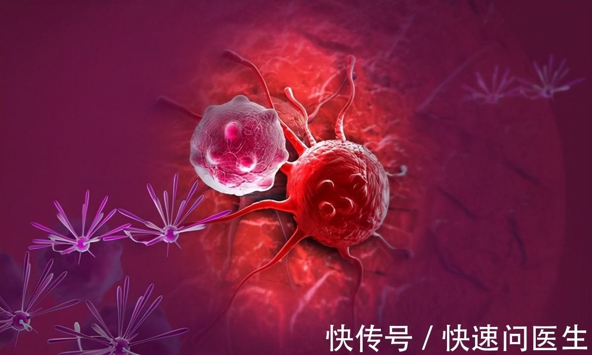 分期|得了结肠癌,先了解“癌症分期”,再进行对症治疗