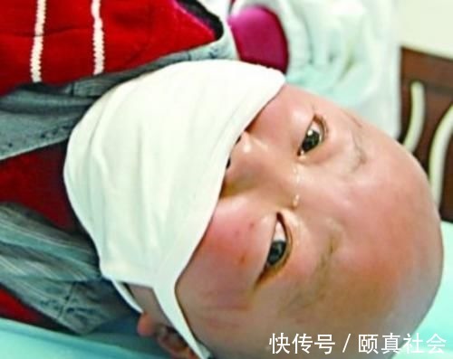 水果|越来越多孩子患“白血病”,这3种水果被盯上,娃再馋也别给买