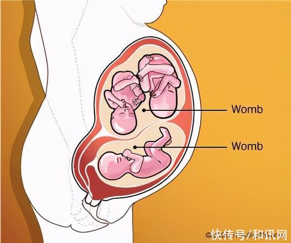 子宫|18岁少女有两个子宫?一月流两次血