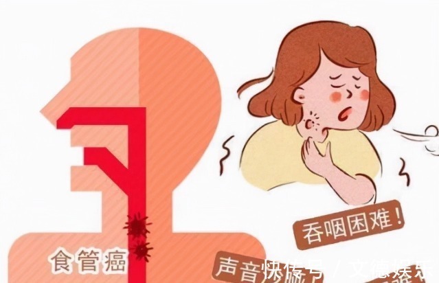 梗阻感|癌症靠近时,身体会如何呼救关键时刻,要读懂身体的求救信号