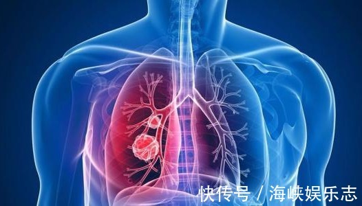 經常生氣易長結節，老中醫一個散結方，化除結節防復發