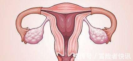棕色|月经一般有4种颜色，若你是前2种，恭喜了，子宫保养的不错