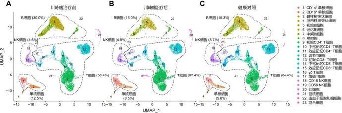 川崎病|川崎病的免疫细胞“地图”