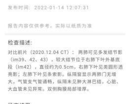 6mm|怀疑肺癌的实性肺结节当地让手术,我回复:信我的,不切