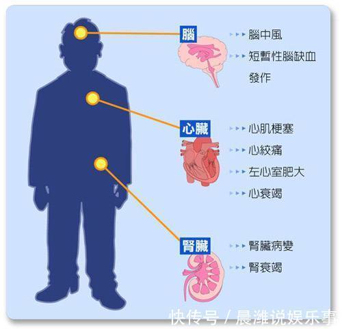 科室|3种不同的高血压，要找不同的医生，挂不同的科室！您知道吗？