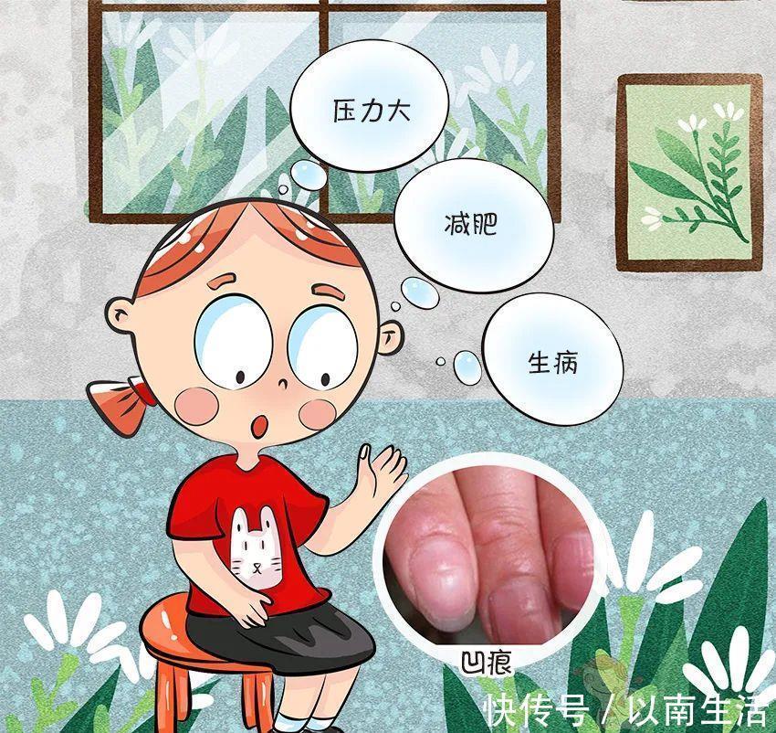 爸妈|倒刺、白斑,这还是宝宝的小指甲吗?要紧吗?宝宝指甲问题大汇总
