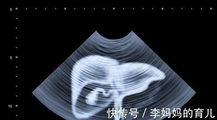 肝脏|肝囊肿的出现,多半与3个原因有关,医生提醒:或许很多人不清楚