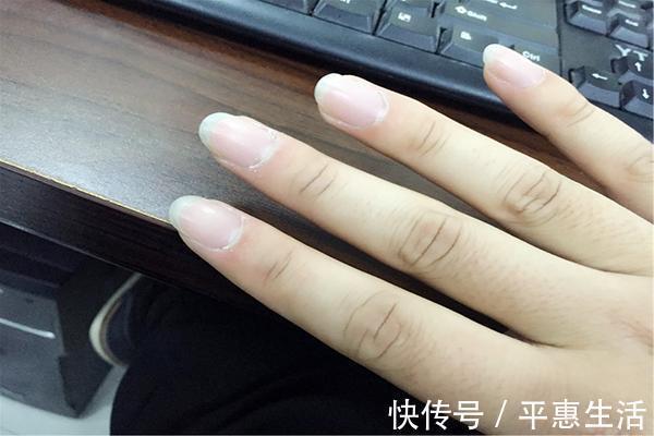 长寿|寿命短的人,身体几处容易发白,你若都没有,则是长寿体质