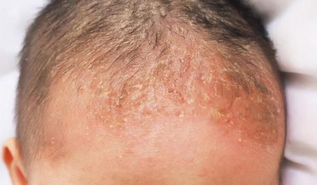 青色|发现新生儿小屁屁上有“淤青”,老公想找护士理论,最后暗暗庆幸