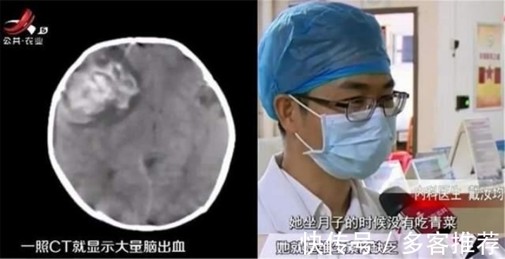 脑出血|哺乳期的妈妈，这种蔬菜千万别吃，宝宝可能会畸形!