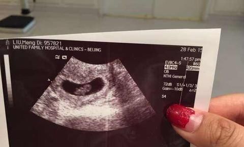 月经周期|胎心胎芽出现的时间,为何有早有晚?这3个原因很说明问题