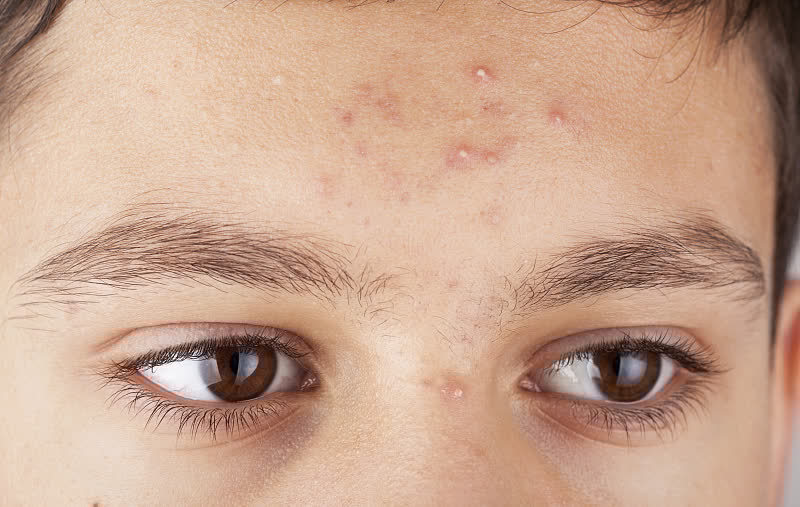 习惯|一些不良习惯易引起便秘，若早上有2个习惯，改善便秘或不再难