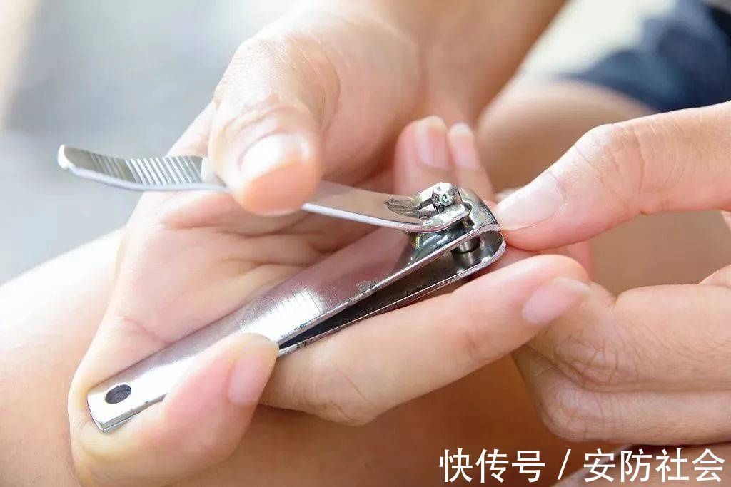 指甲缝|指甲剪不对带来大麻烦，这才是剪指甲的正确方法！