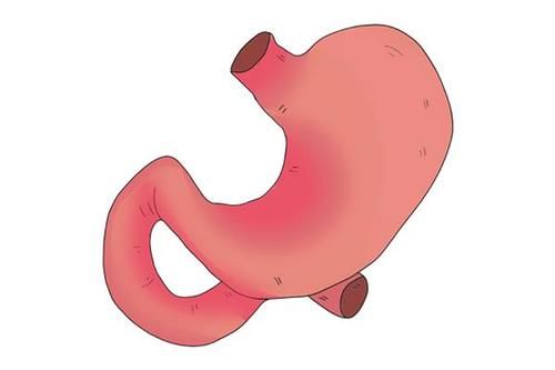 胃部|胃阴虚,胃阳虚,胃热,分别如何鉴别?中医养胃3方,请收好