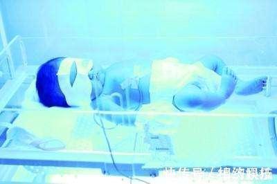 漂亮|怀孕期间想要宝宝白净漂亮,不长胎毒和黄疸,注意以下几点