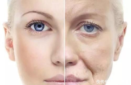 项目|我想祛除法令纹,医美的诸多项目,该如何选择?