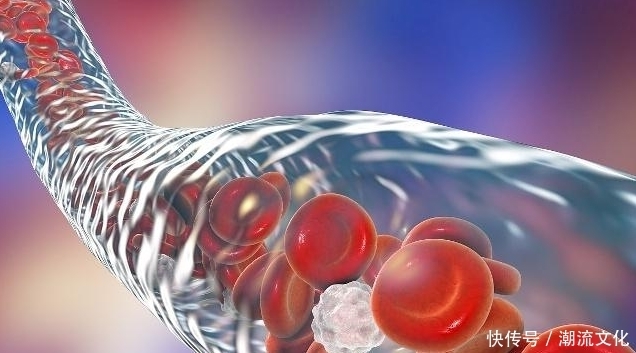 无论男女年过40岁,都要养血管,少吃3、多吃2,预防心血管疾