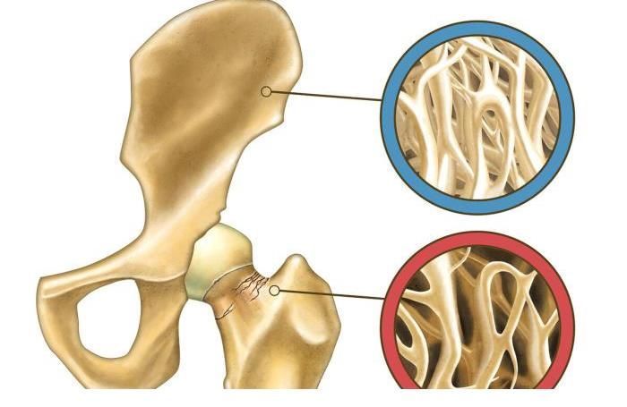 骨质疏松|吃一次等于10杯牛奶,“养骨高手”发现了,你若爱吃,骨骼日渐强壮