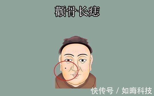 颧骨|“万里挑一的5颗痣”，男人升官，女人升福，十人九福，皇帝命！