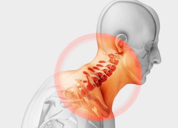 脊椎|颈椎病只有脖子疼专家这十个部位疼痛也是颈椎病