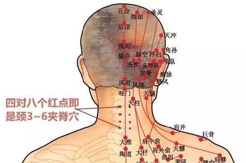  寒气|颈肩出现问题，久治不断根，其实是此处“寒气”没有化解