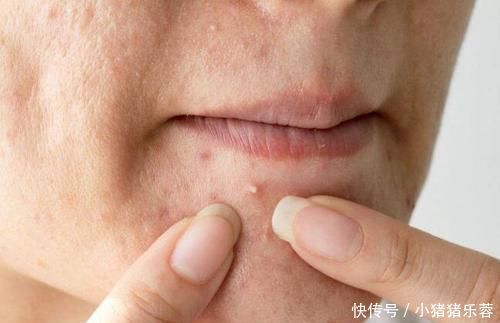 内分泌失调|女性内分泌失调，身体的6个变化一目了然，若你有，及时调节