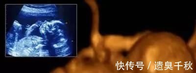 皱缩状|一组图记录怀胎十月,胎儿发育全过程,看完后,感叹生命神奇
