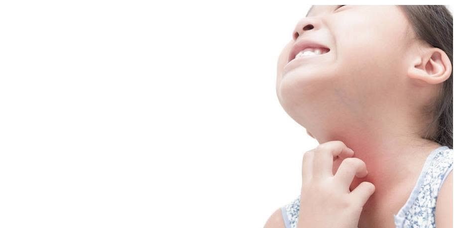 婴儿|冬季天气干冷,宝宝容易爆发湿疹?可能只是父母这三件小事没做对