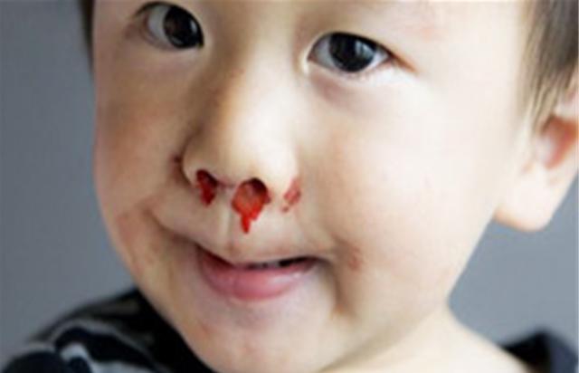 鼻腔|经常“挖鼻孔”的孩子,长大逃不出这3种结局,父母别不当回事