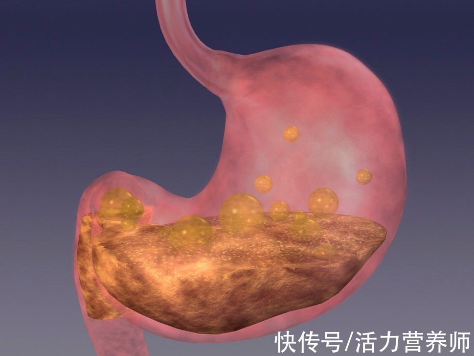 癌症|2020年癌症调查数据：新发胃癌患者48万，想要远离坚持4个习惯