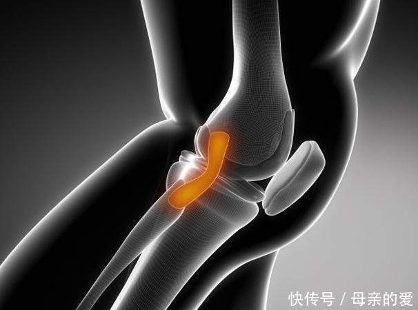 脊柱|毁膝、毁腰、毁全身！骨科专家都“避而远之”事情，你每天在做！