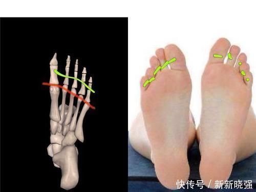 跖骨|瑜伽干货分享：搞不定脚掌，就别说你知道根基