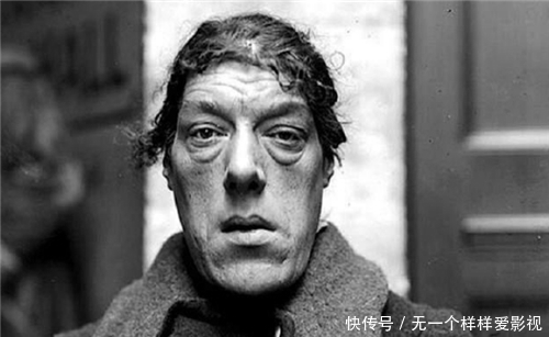 赚钱|母爱有多伟大?“怪物”玛丽为孩子参加选丑比赛,用自己外貌赚钱