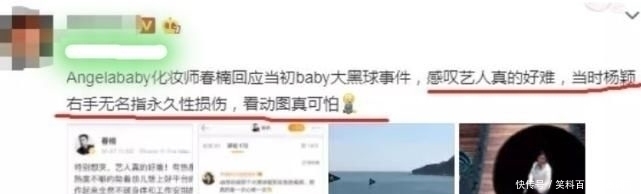 跑男|誰還記得跑男“大黑球”事件楊穎無名指永久損傷，粉絲心疼不已