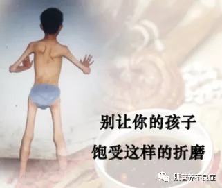 肌肉|肌营养不良的症状有哪些?是什么原因导致的?