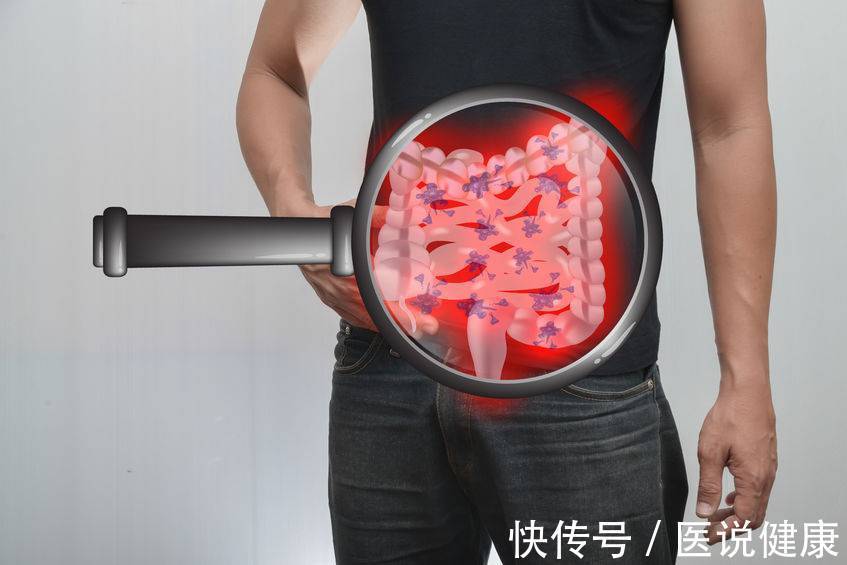 饮食习惯|结直肠癌发病,或与这3个因素有关,若你也有,不能忽视