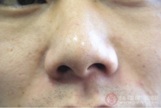 鼻子黑头毛孔粗大怎么解决